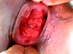 Gay anal sex to the extreme with a solo boy