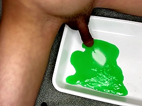 Japanese woman gets catheter for green pee injection